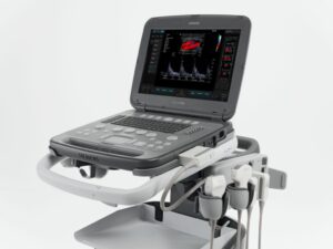 Ecografo Portatile Acuson P500